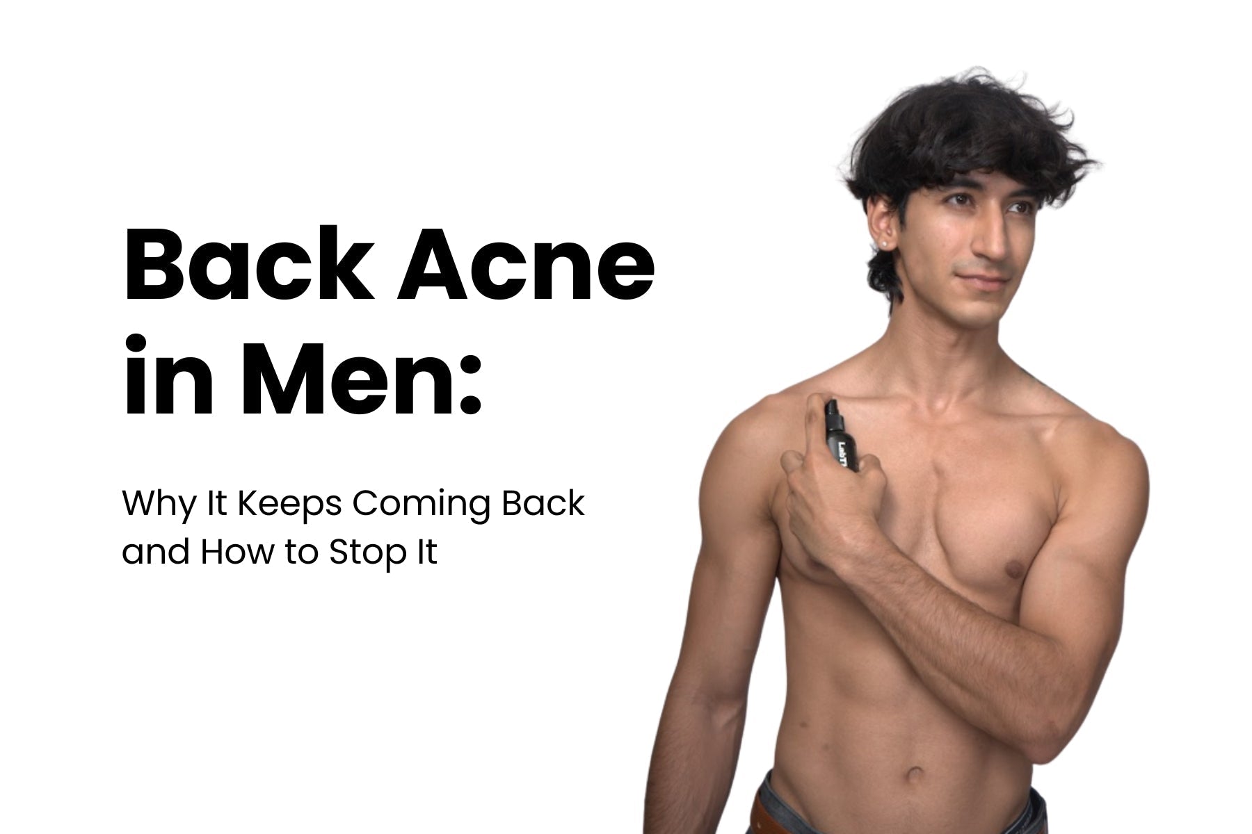 Back Acne in Men: Why It Keeps Coming Back and How to Stop It