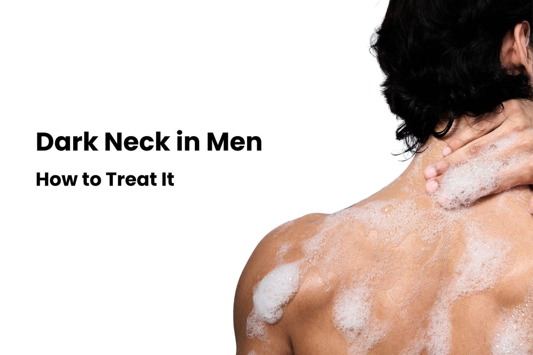 Dark Neck in Men and How to Treat It