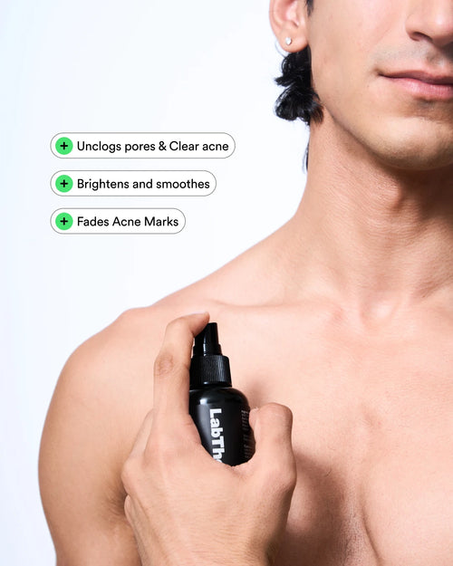 Acne Control Body Spray - hover