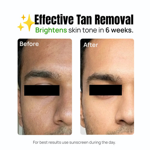Detan Face Wash - hover