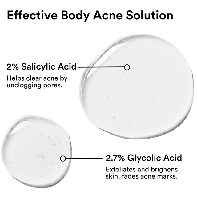 Acne Control Body Spray